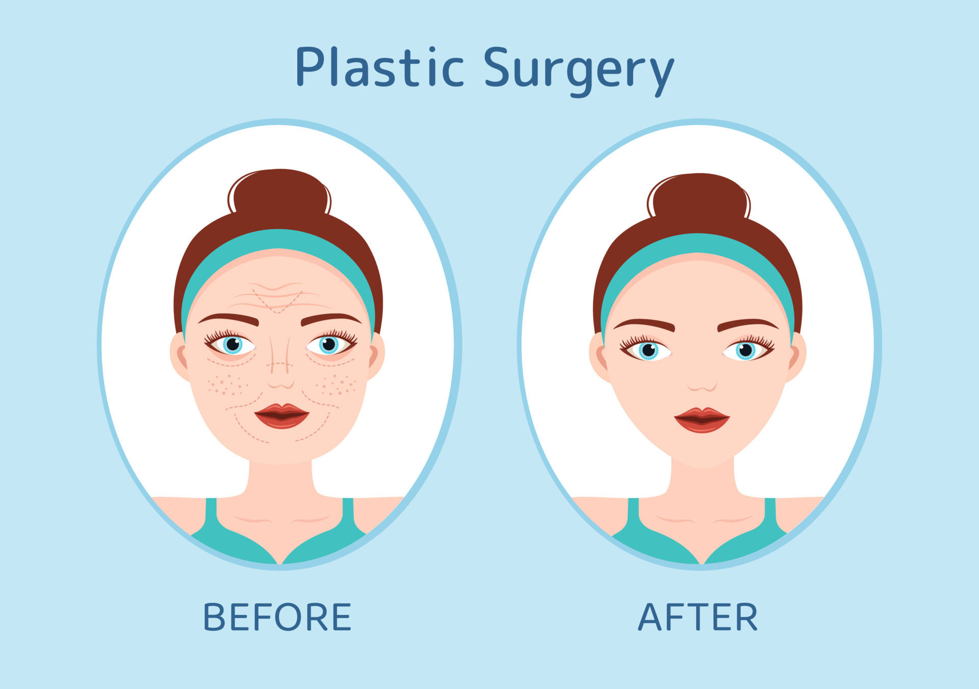 Plastic Surgery